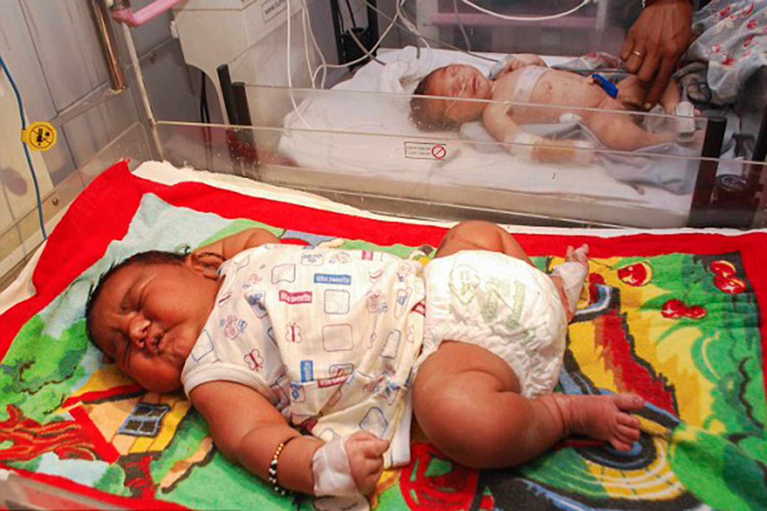 Nace en la India el bebé más grande del país