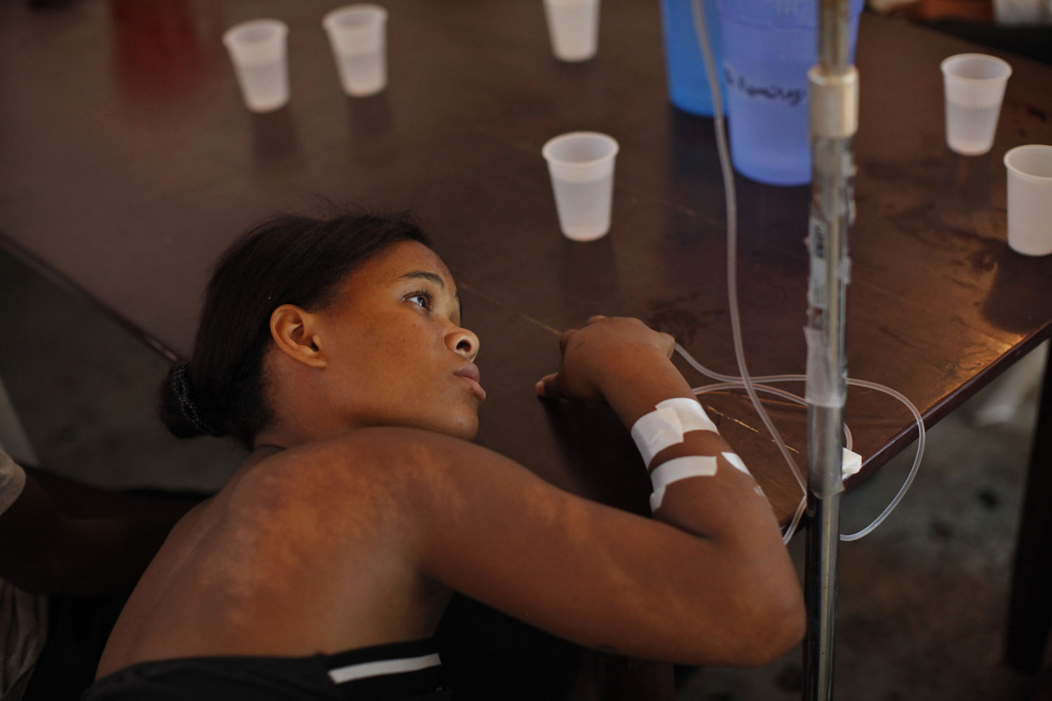 El cólera se expande de Haití a República Dominicana y México, donde ya se han confirmado 171 casos
