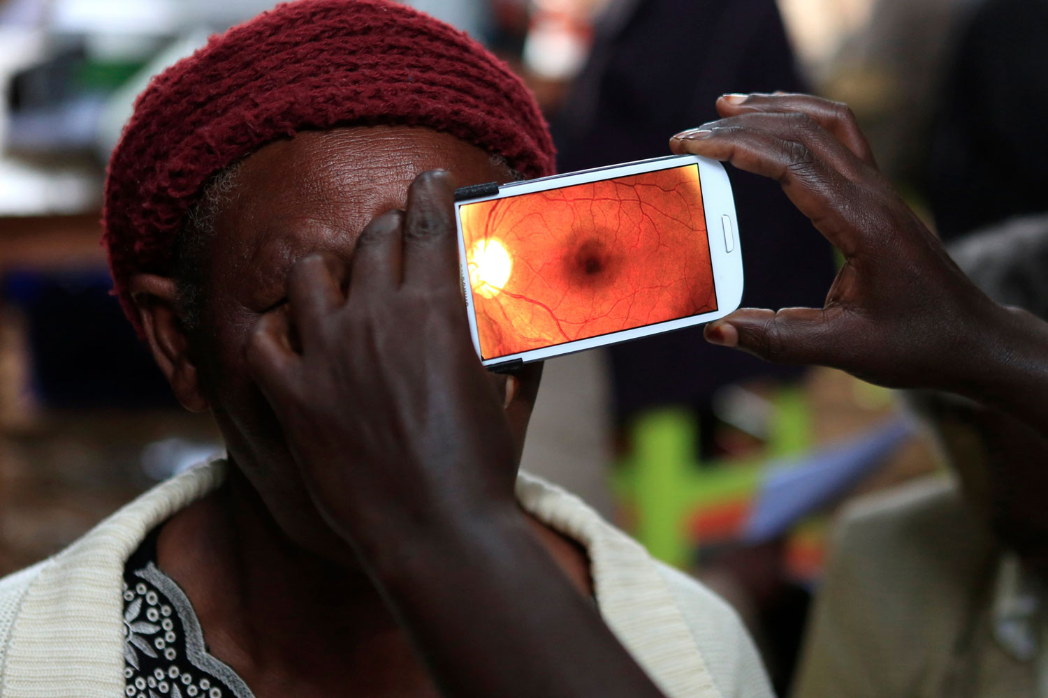 El Centro Internacional de la Salud Ocular (ICEH) revisa la vista de 5.000 personas en Kenia