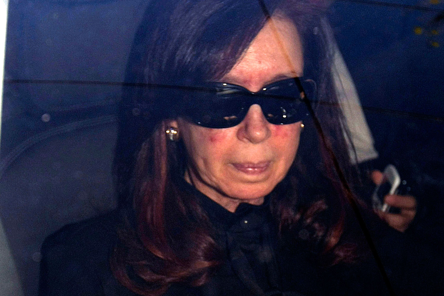 Cristina Fernández pasa de nuevo por quirófano para eliminar un hematoma cerebral.