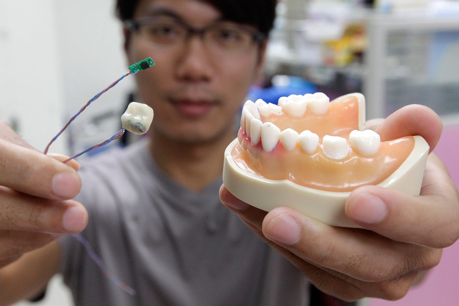 "Smart Tooth" es un sensor dental que registra la actividad oral para emitir diagnósticos