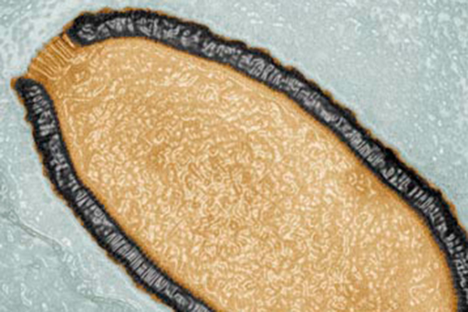Pithovirus un nuevo virus gigante que sobrevive durante 30.000 años
