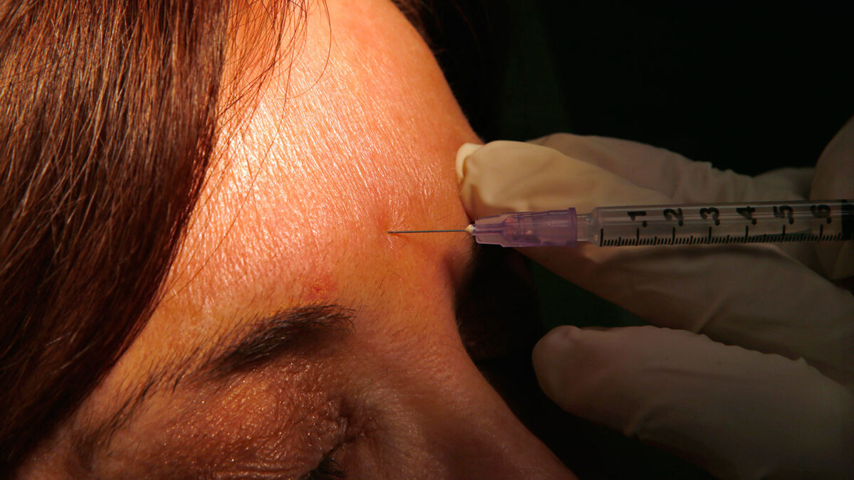 Según un estudio, el botox tiene efectos antidepresivos