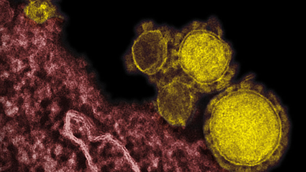 Detectado en Grecia el primer caso de síndrome respiratorio de coronavirus de Oriente Medio