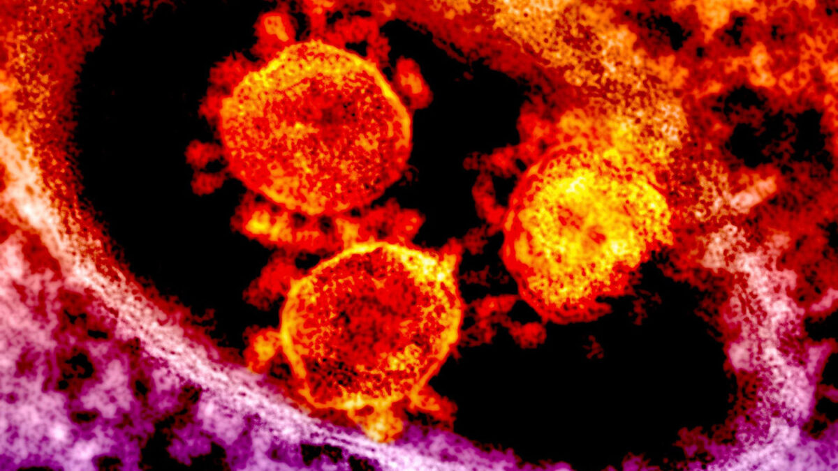 Posible primer caso de coronavirus MERS en Egipto