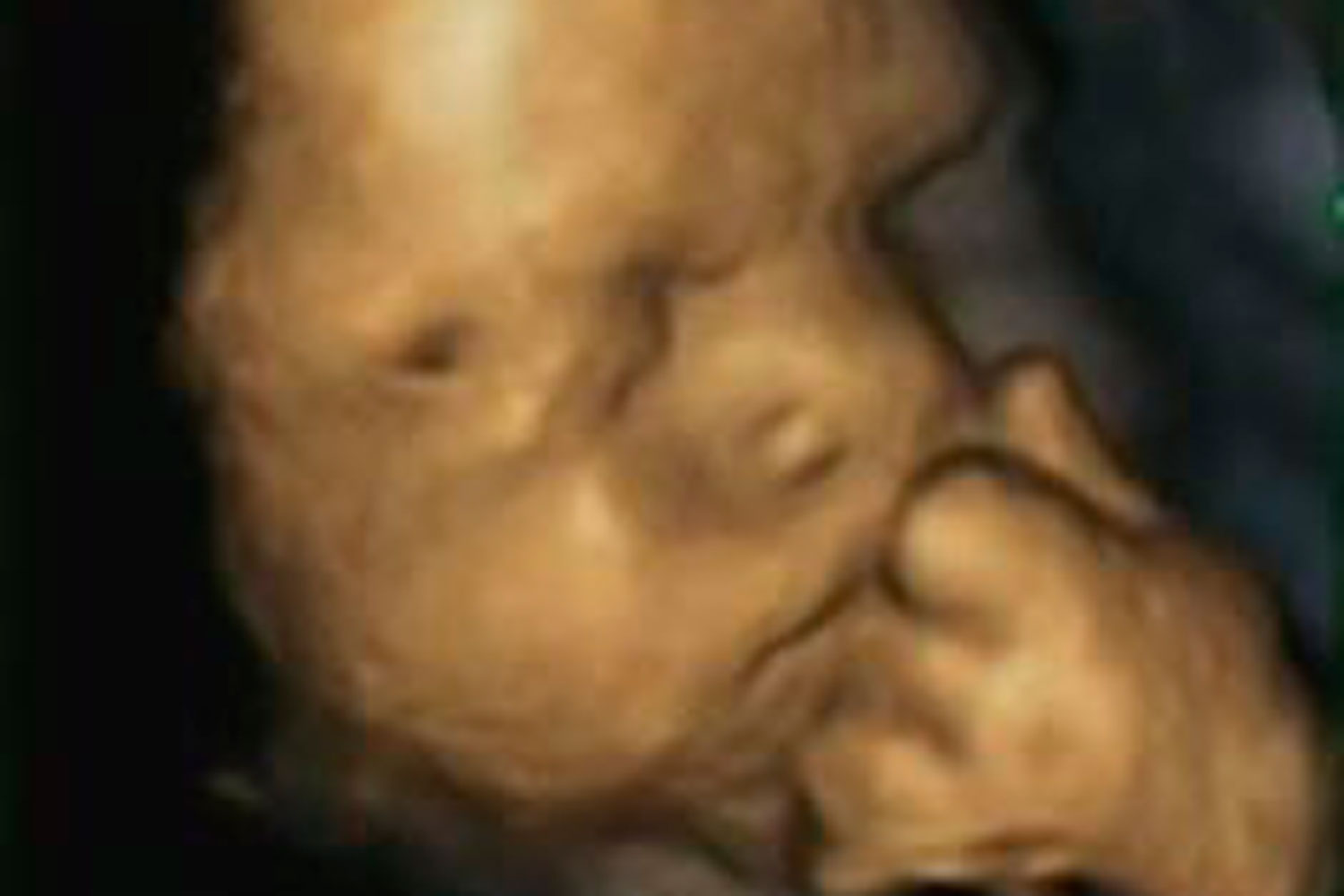 Un estudio desvela que los bebés se inquietan en el útero cuando sus madres se sienten mal