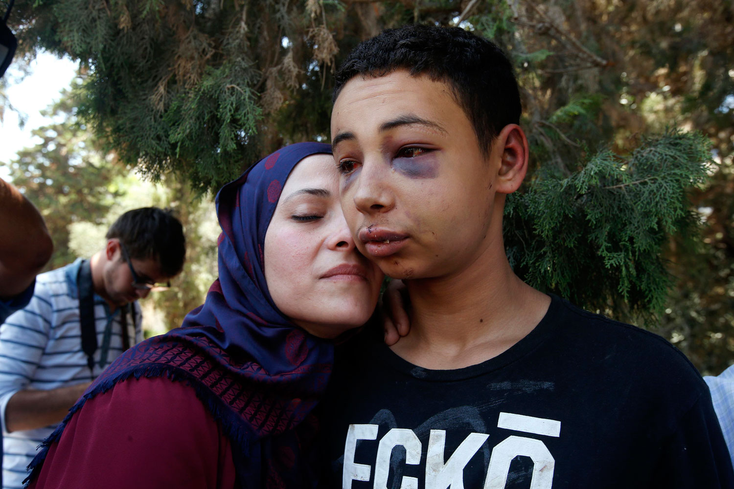 Liberado el adolescente palestino-estadounidense linchado por policías israelíes
