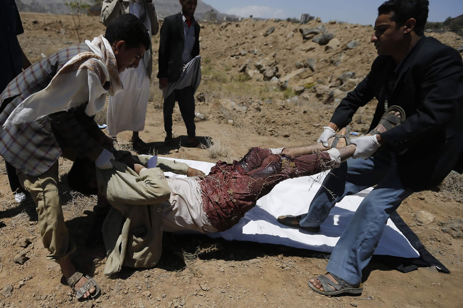 350 muertos en cinco días y cientos de heridos colapsan hospitales en Yemen tras el acuerdo de paz