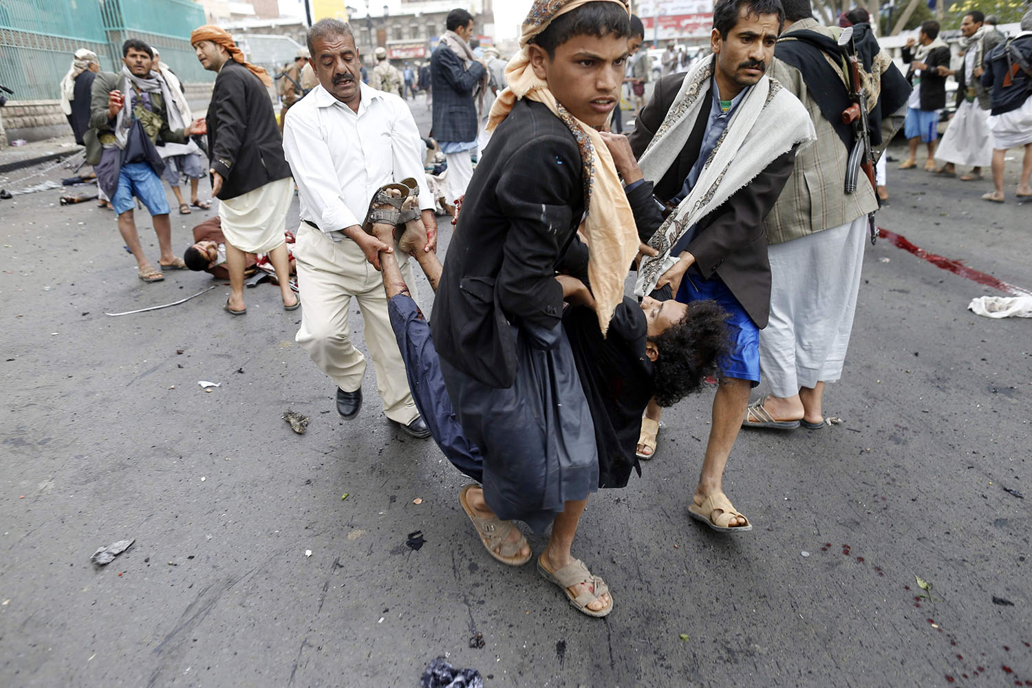 Al menos 45 muertos y 150 heridos en un atentado suicida contra una manifestación de chiíes en Saná.