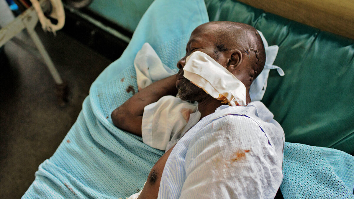 Un anciano se recupera en el hospital Coast General en Mombasa