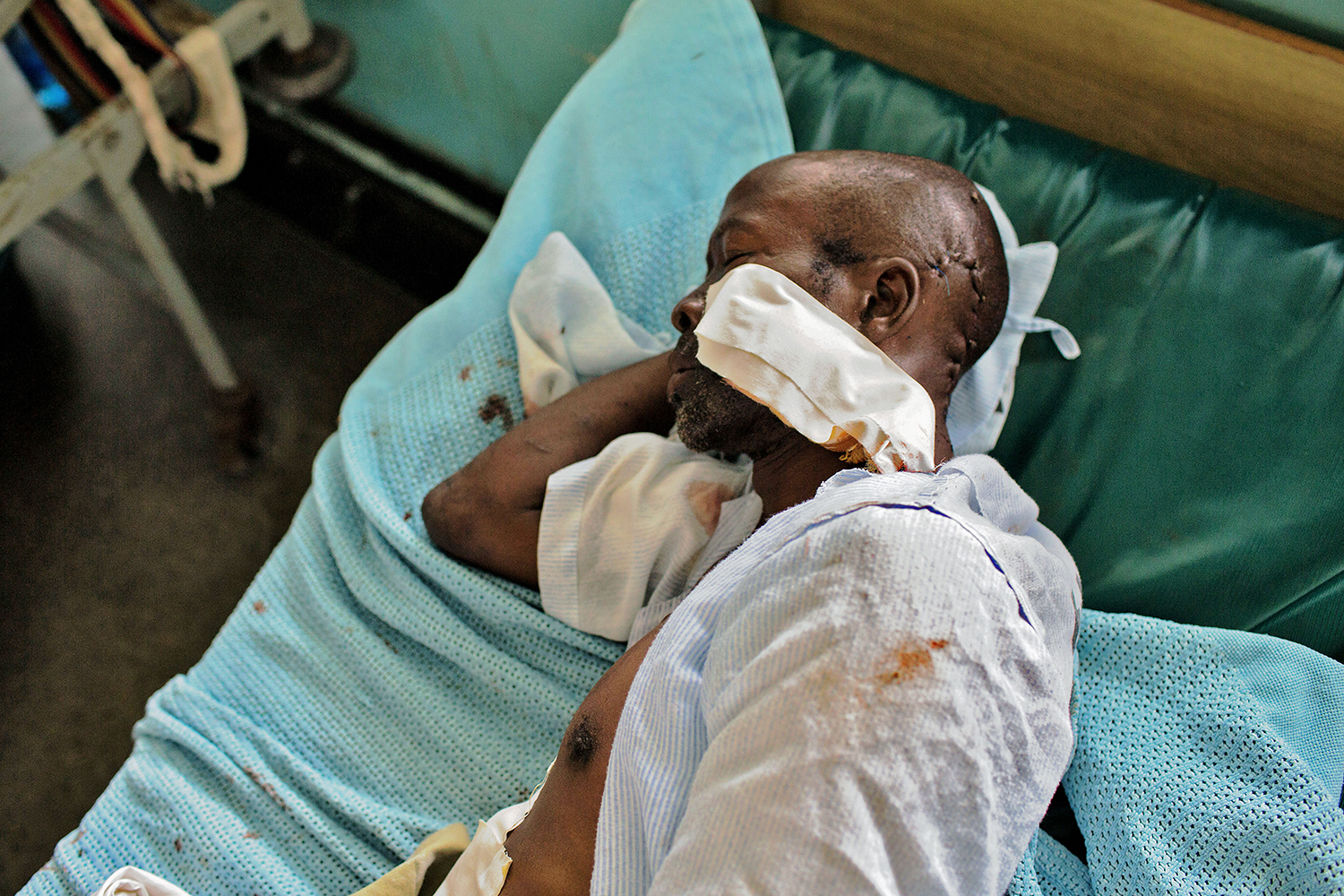 Un anciano se recupera en el hospital Coast General en Mombasa