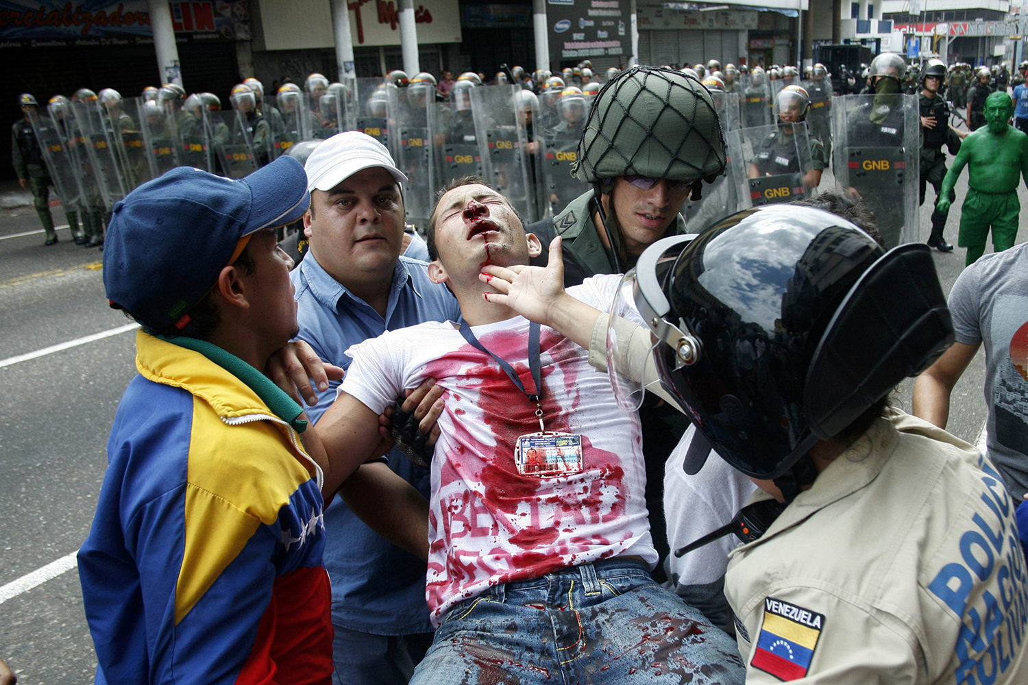 A un año de las protestas en Venezuela