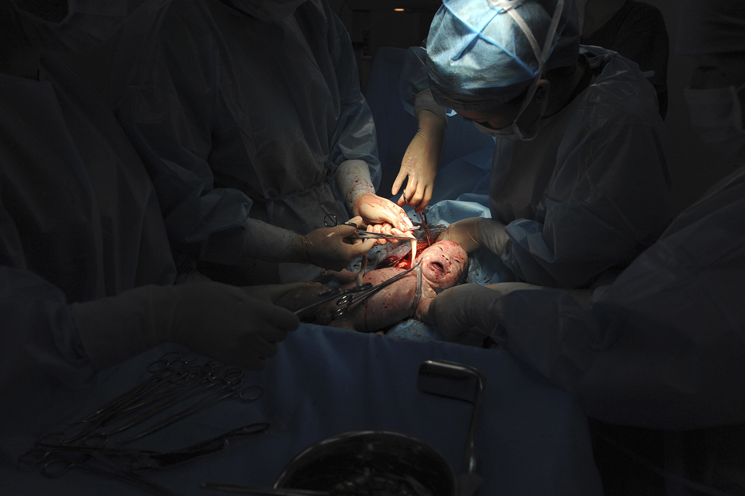 Un médico deja olvidado el móvil en el vientre de una paciente