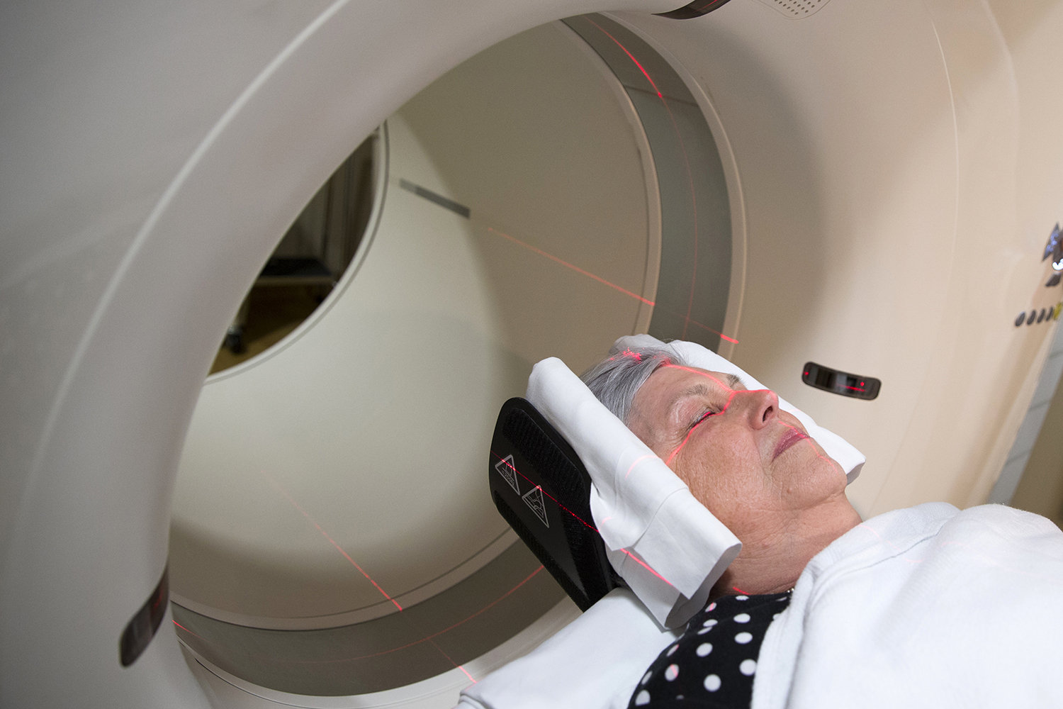 Esperan poder anticipar la aparición del alzheimer con el estudio de imágenes del cerebro