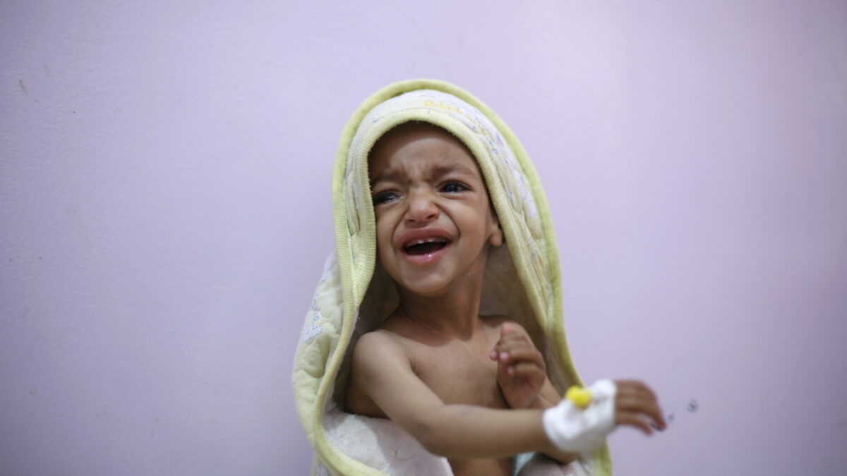 El coste de la guerra en Yemen: malnutrición, muertes y refugiados