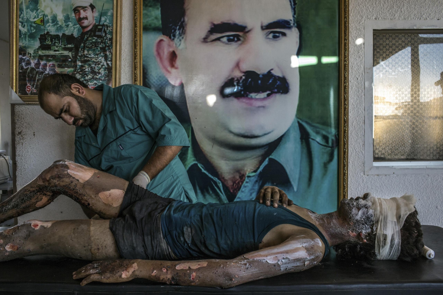La heridas de la guerra en Siria, primer premio de 'Actualidad General' del World Press Photo
