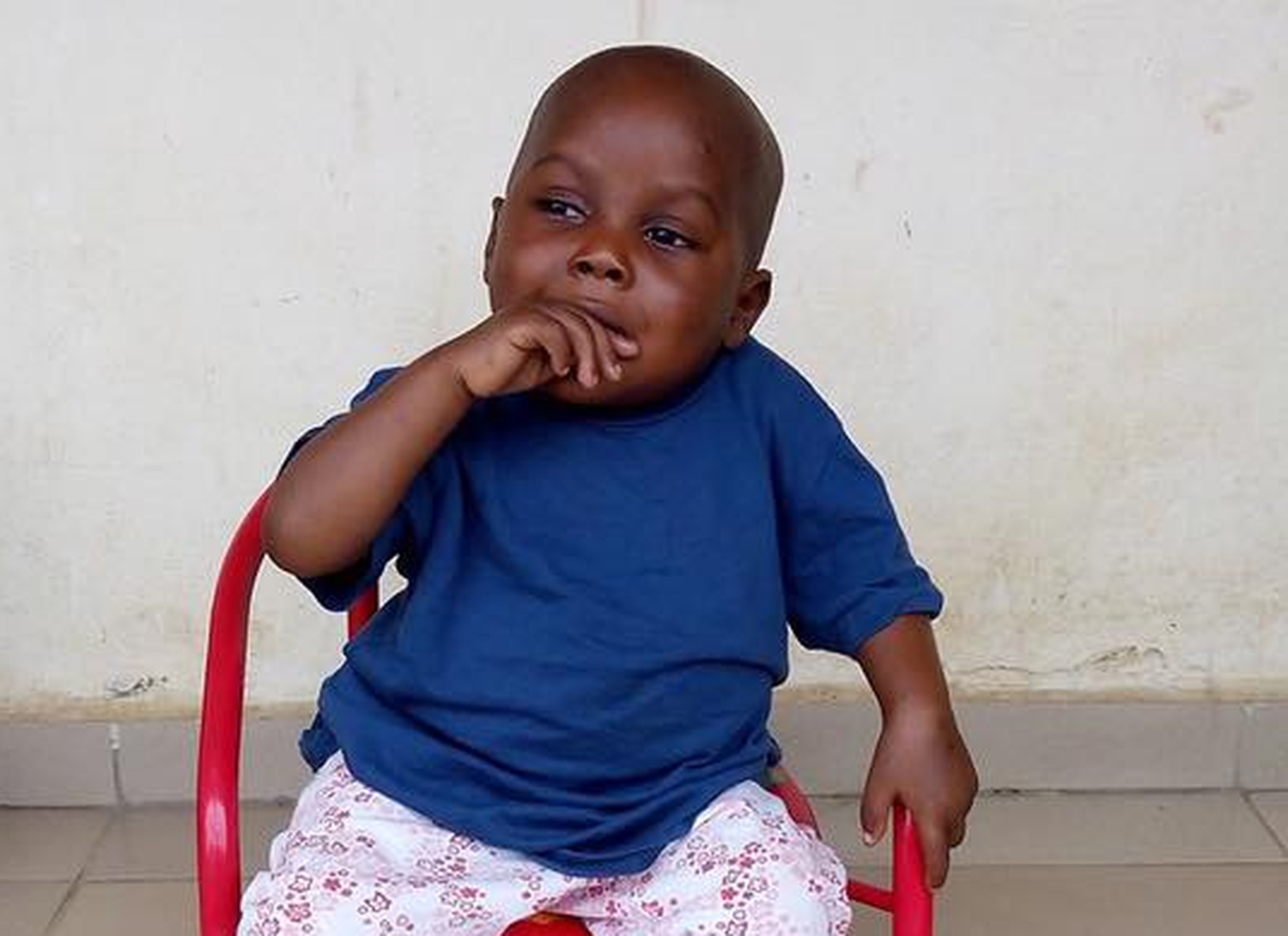 La milagrosa recuperación del niño famélico auxiliado antes de morir en África