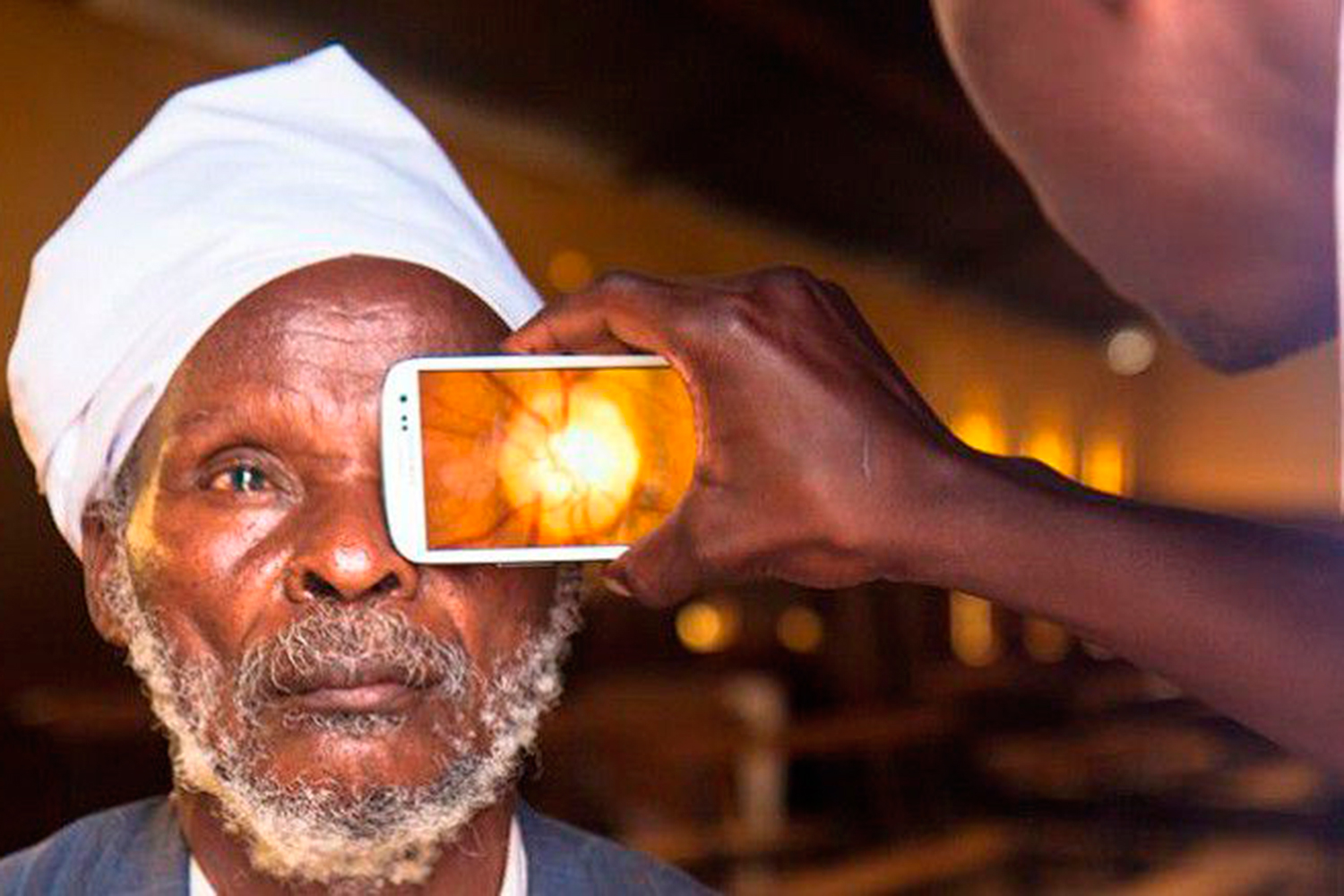 La aplicación que puede ayudar a prevenir la ceguera en los países pobres