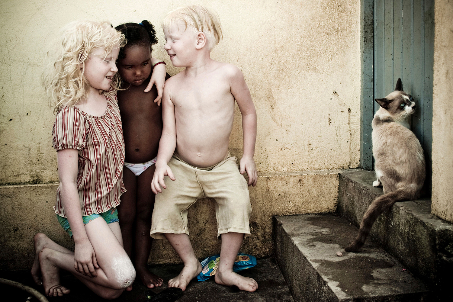 La ONU alerta sobre la extinción total de los albinos en Malawi