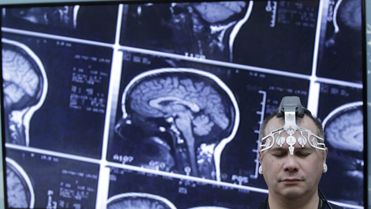 El experimento que tratará de resucitar a pacientes con muerte cerebral