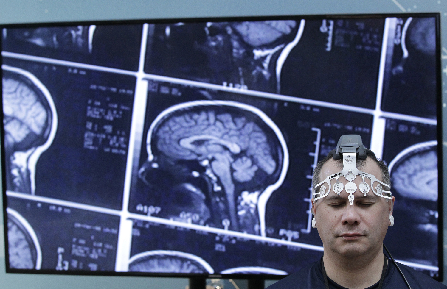 El experimento que tratará de resucitar a pacientes con muerte cerebral