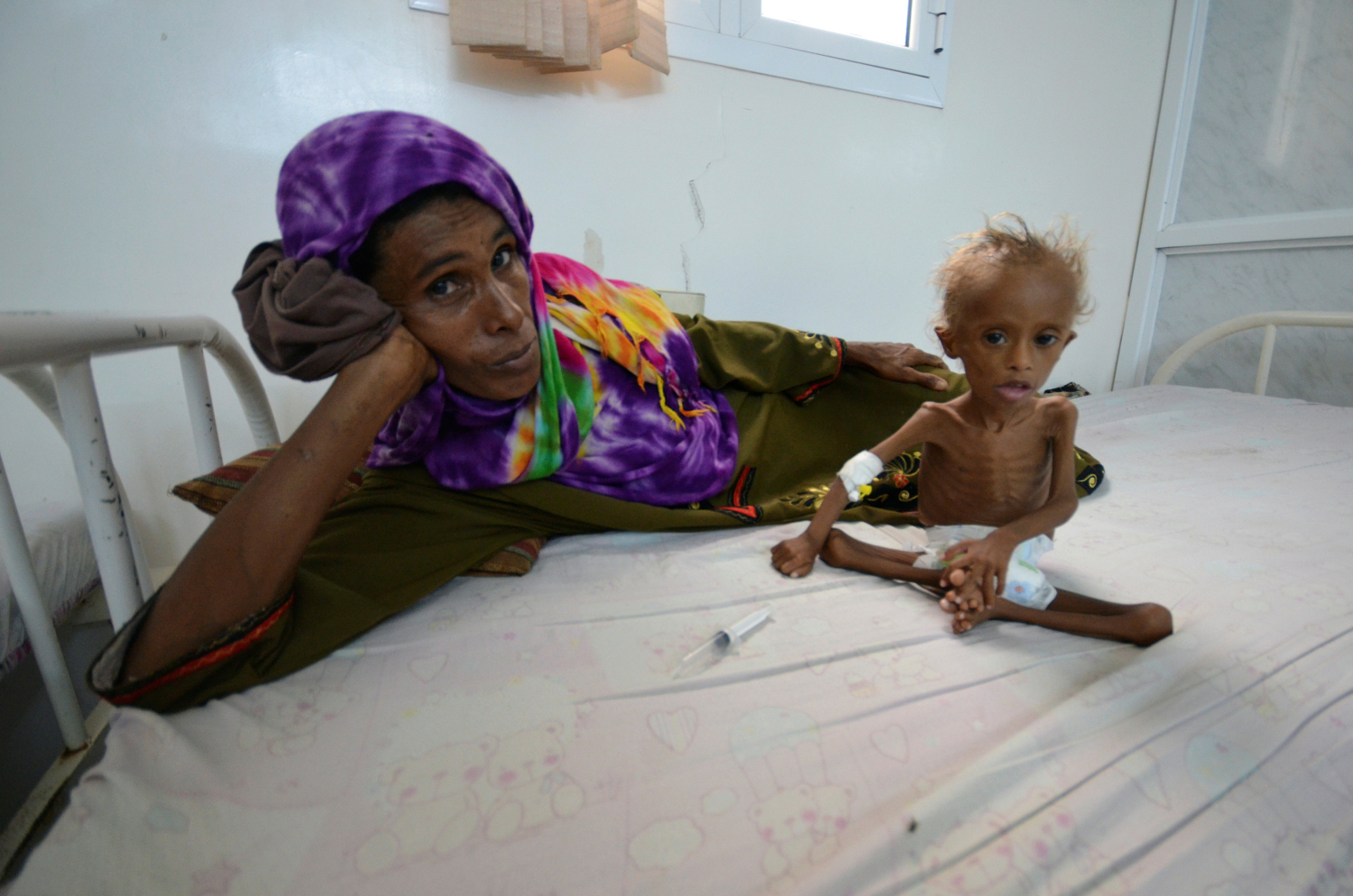 Los niños en Yemen mueren antes de cumplir cinco años