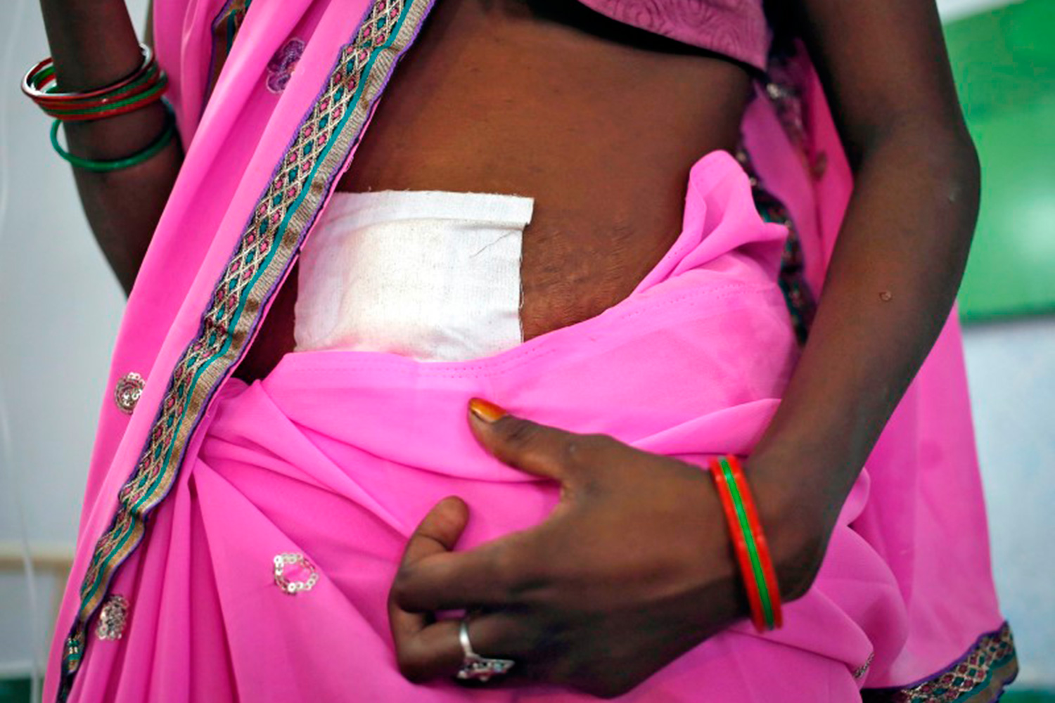 India cierra sus campos de esterilización de mujeres