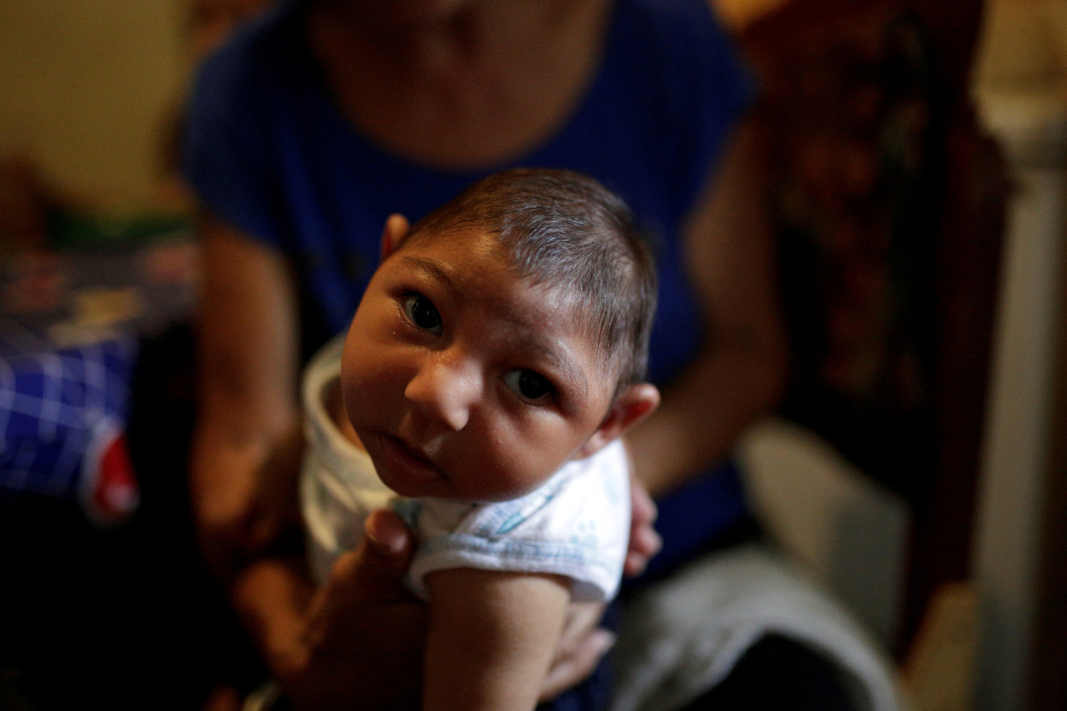 El Gobierno de Maduro silencia los casos de bebés con microcefalia por el Zika