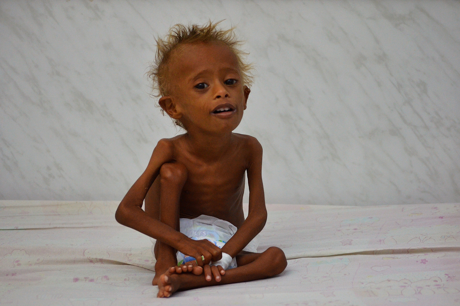Un niño muere cada 10 minutos en Yemen