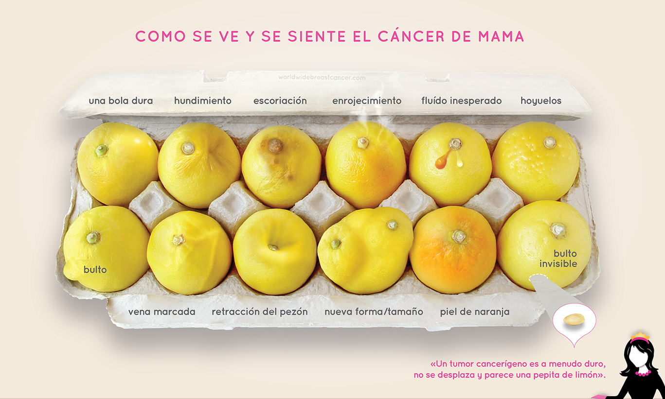 12 formas en las que el cáncer de mama puede manifestarse. (Ilustración: worldwidebreastcancer.org)