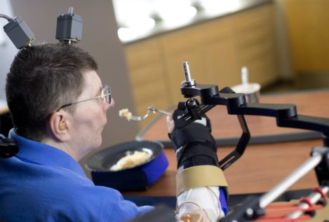 Un tetrapléjico recupera la movilidad en un brazo gracias a una nueva neuroprótesis