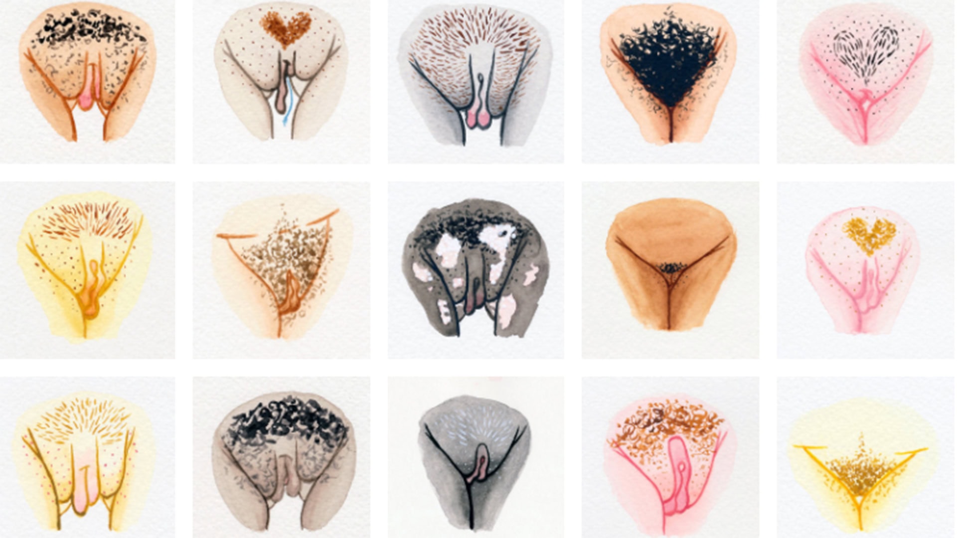 Vulva tipos