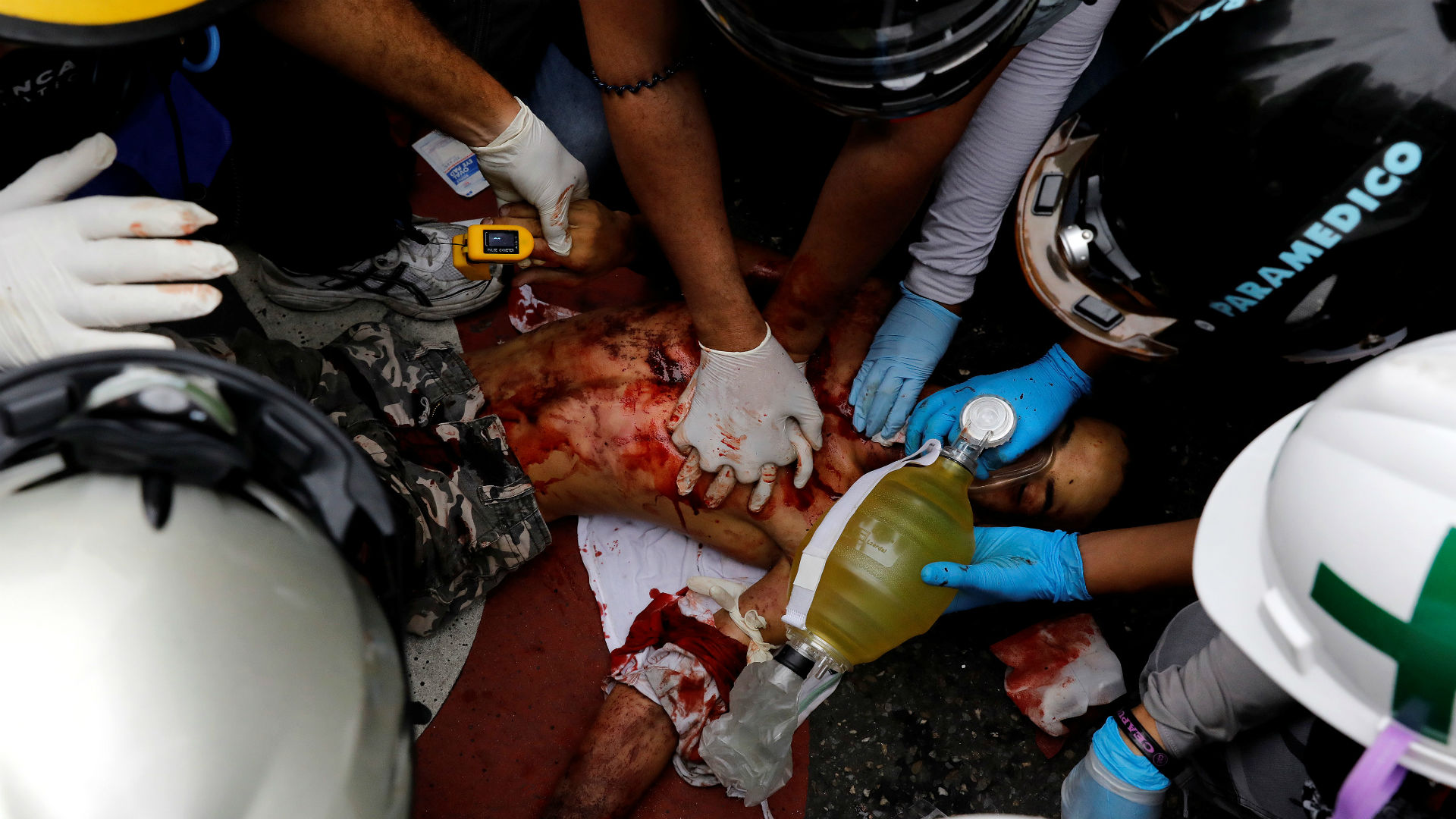 Un muerto y varios heridos en la reciente protesta opositora en Venezuela