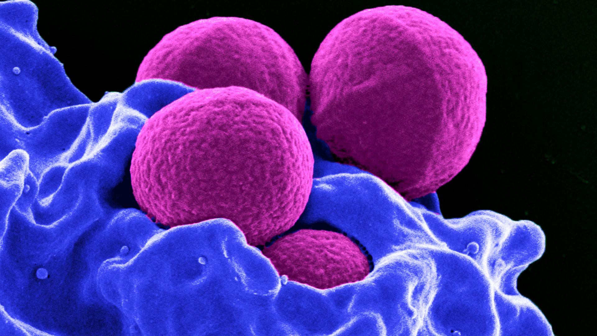 Bacterias resistentes, el mortal enemigo del siglo XXI
