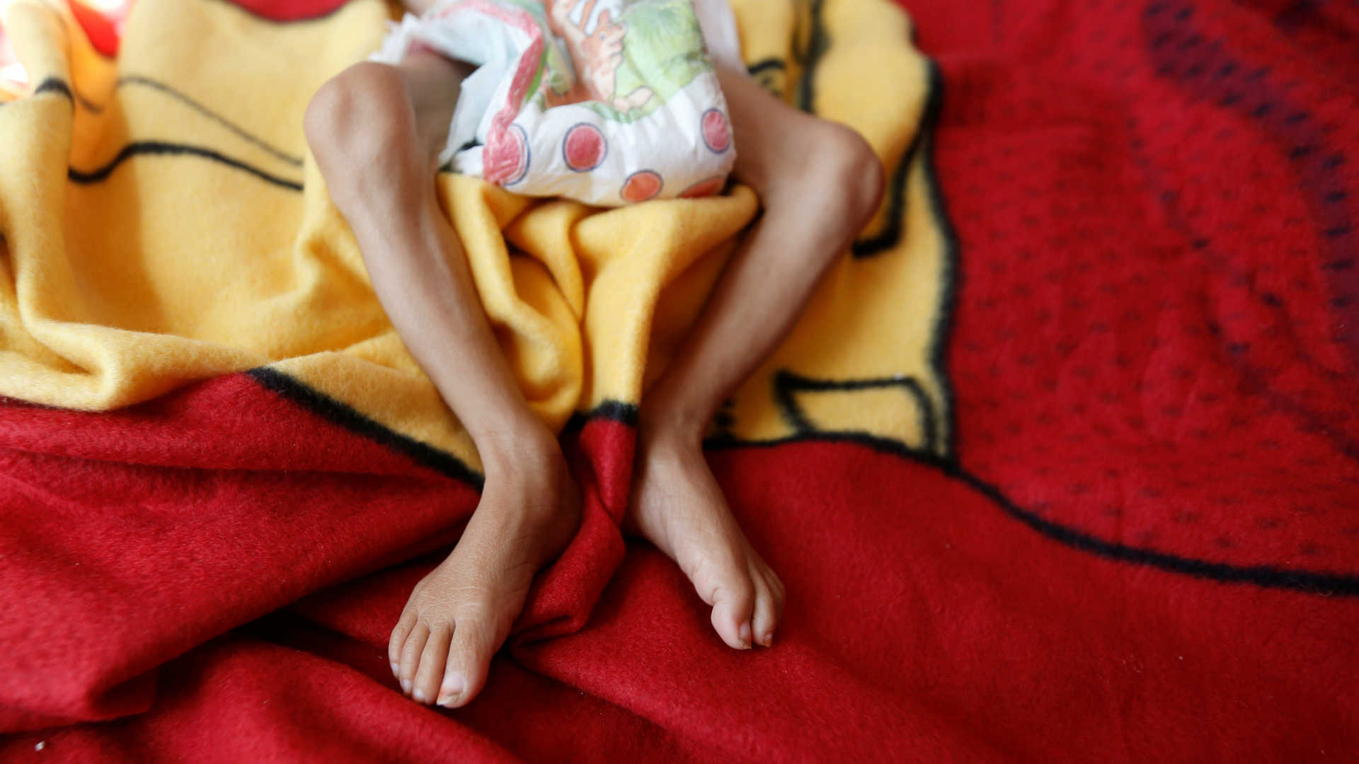 Más de 11 millones de niños necesitan desesperadamente ayuda en Yemen
