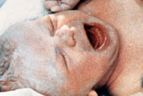 Nace el primer bebé del mundo a partir de un óvulo vitrificado automatizadamente