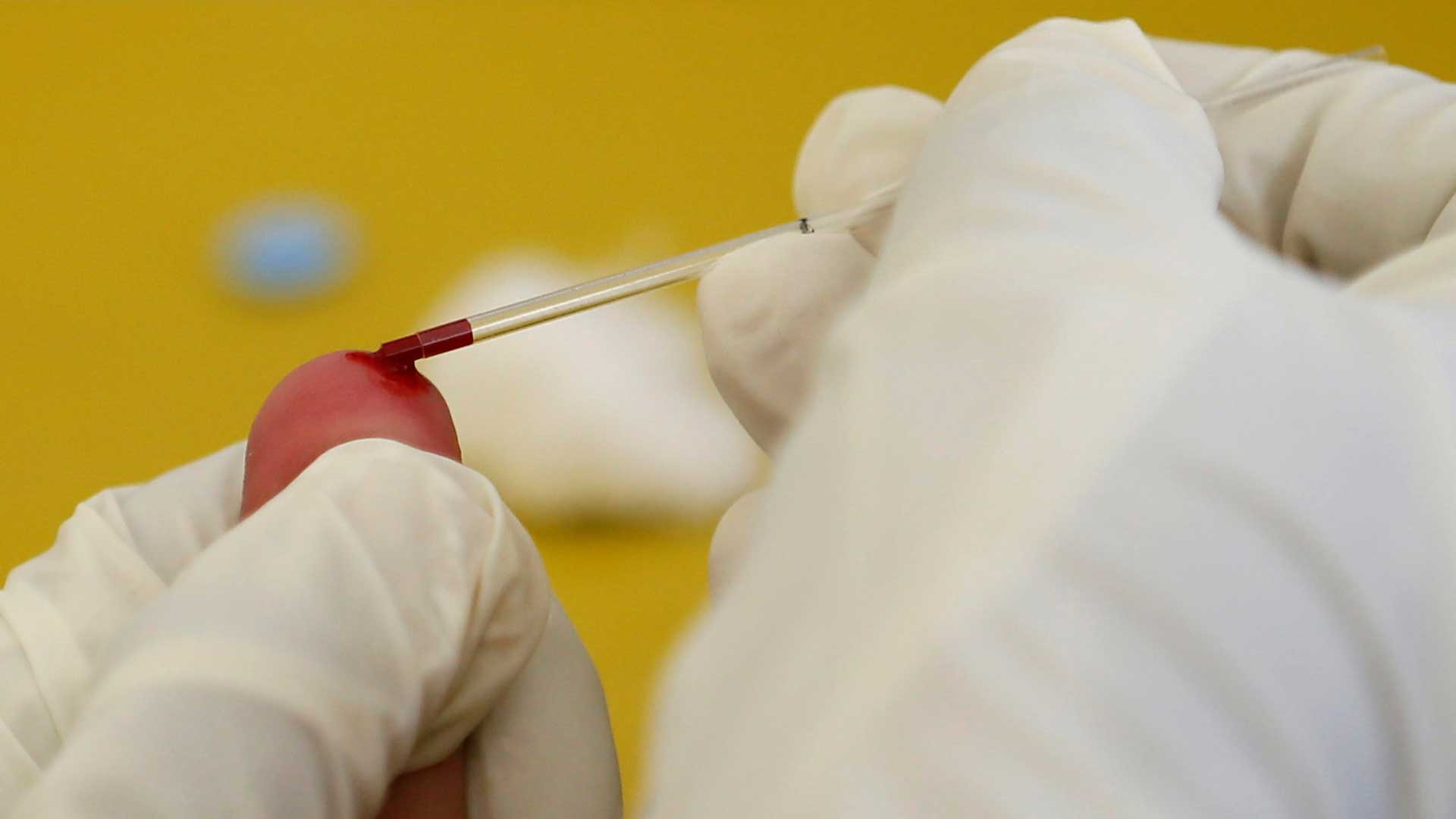 La prueba para el autodiagnóstico del VIH ya está disponible en las farmacias españolas