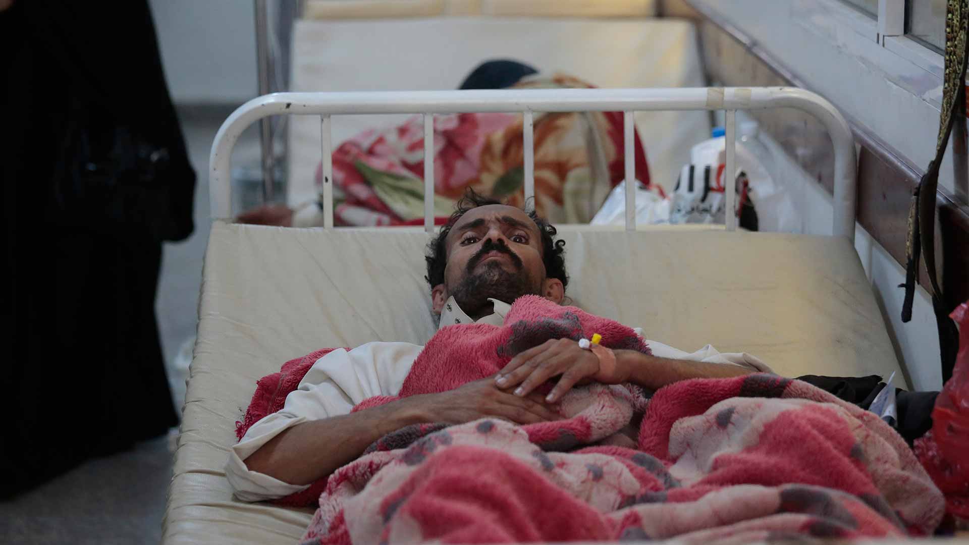 El 25% de los pacientes de diálisis renal en Yemen terminan muriendo