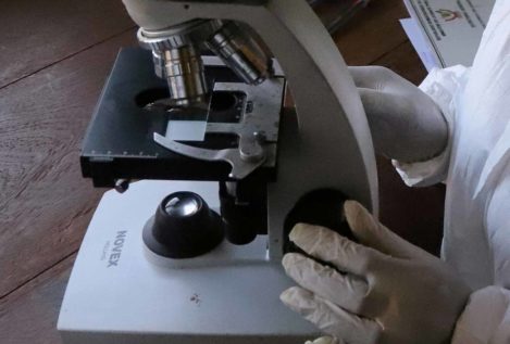 Los anticuerpos "unicornio" de los supervivientes del ébola neutralizan el virus