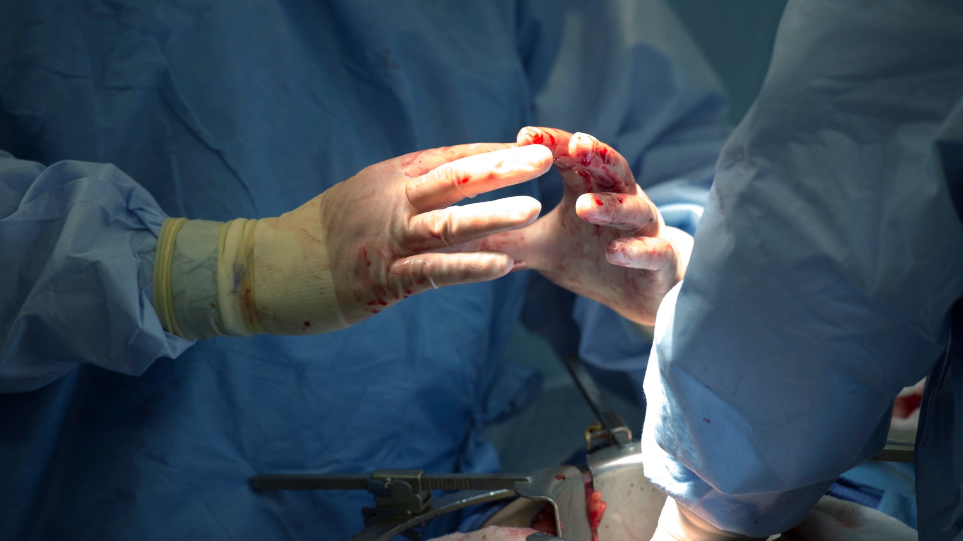 España registra unos 13 incidentes diarios por implantes defectuosos