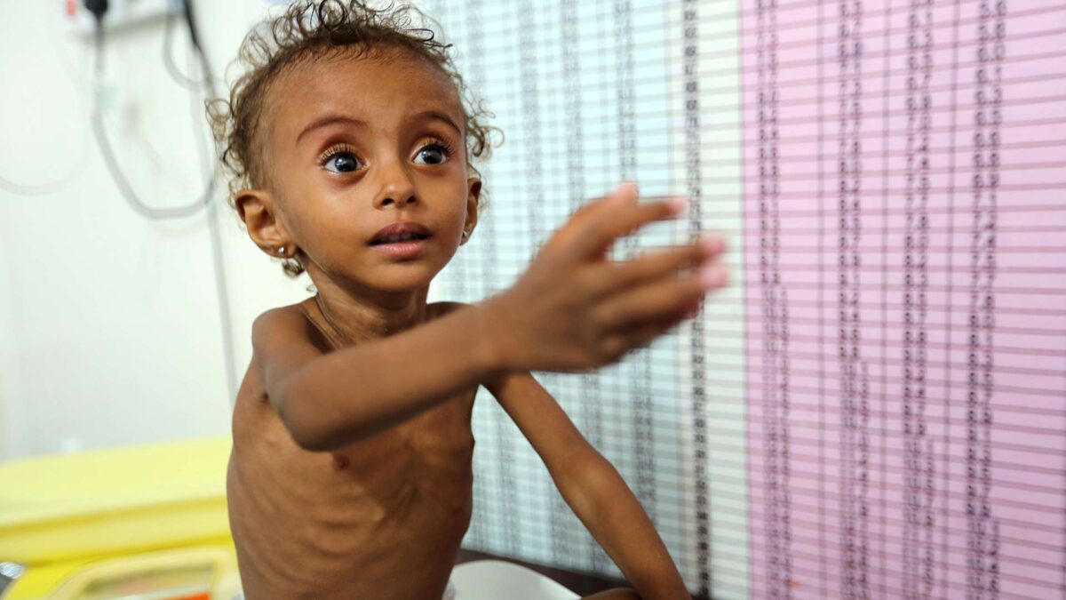 Yemen: el peor lugar para ser niño