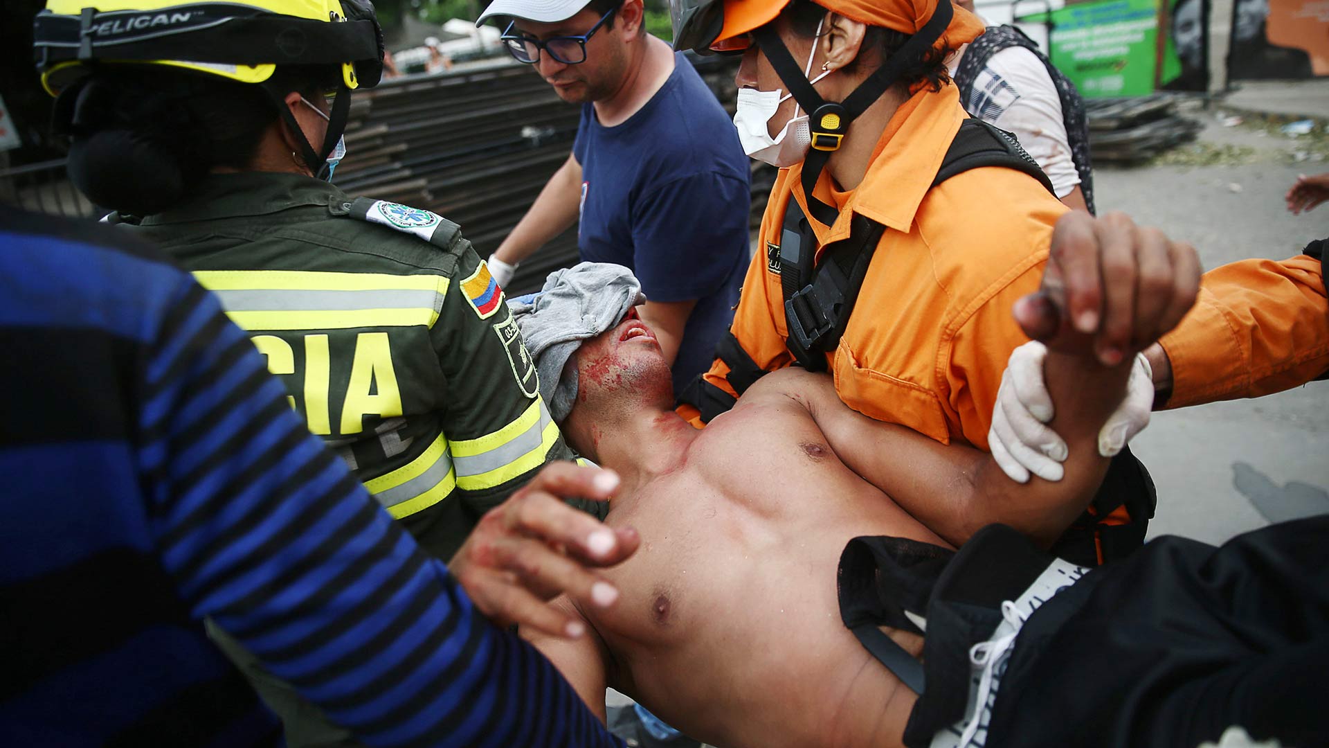 Al menos cuatro muertos y 285 heridos en los enfrentamientos en la frontera de Venezuela con Brasil