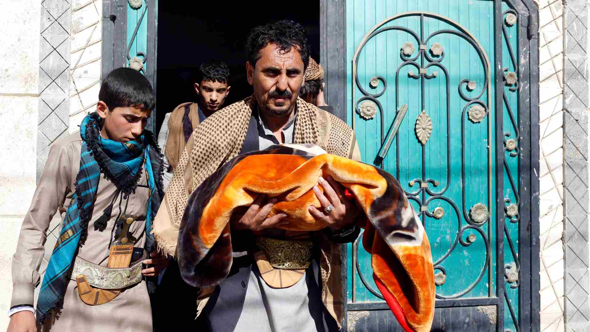 Mueren dos bebes siameses en Yemen por no poder ser evacuados