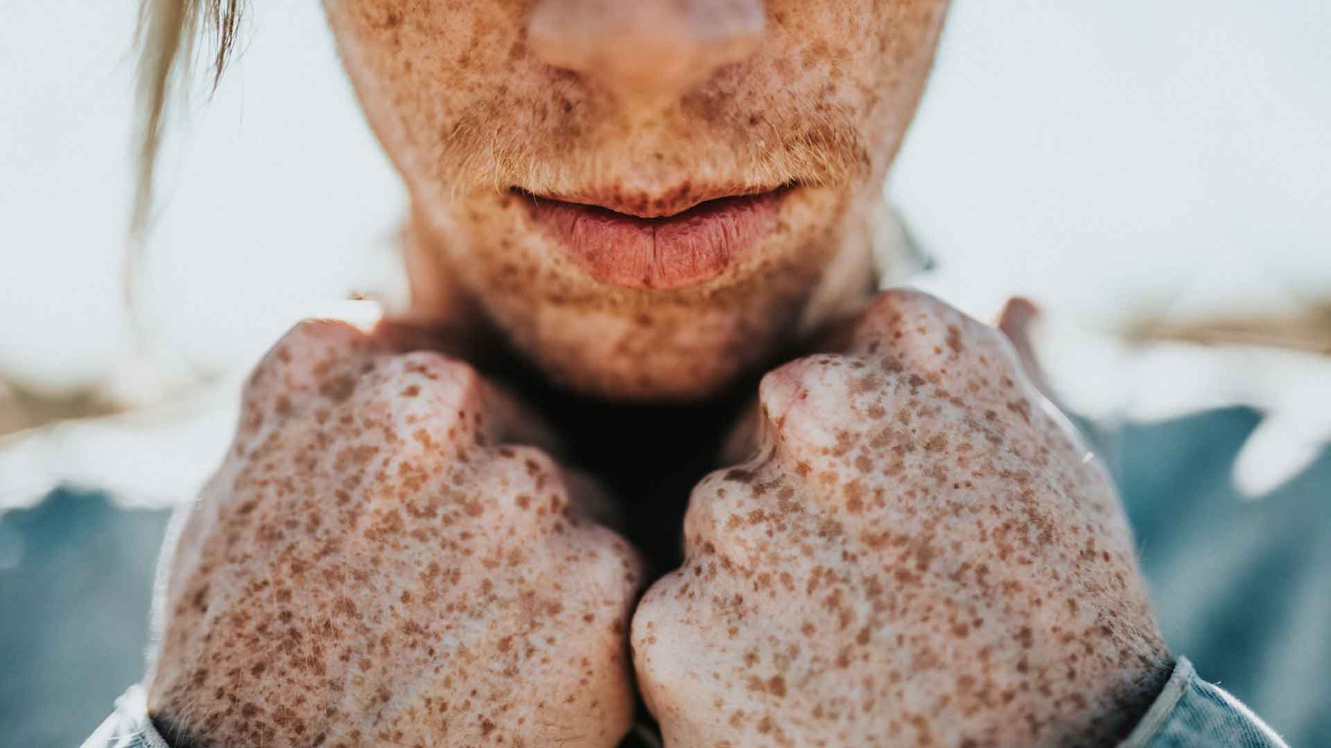 Mitos y realidades sobre la salud de la piel