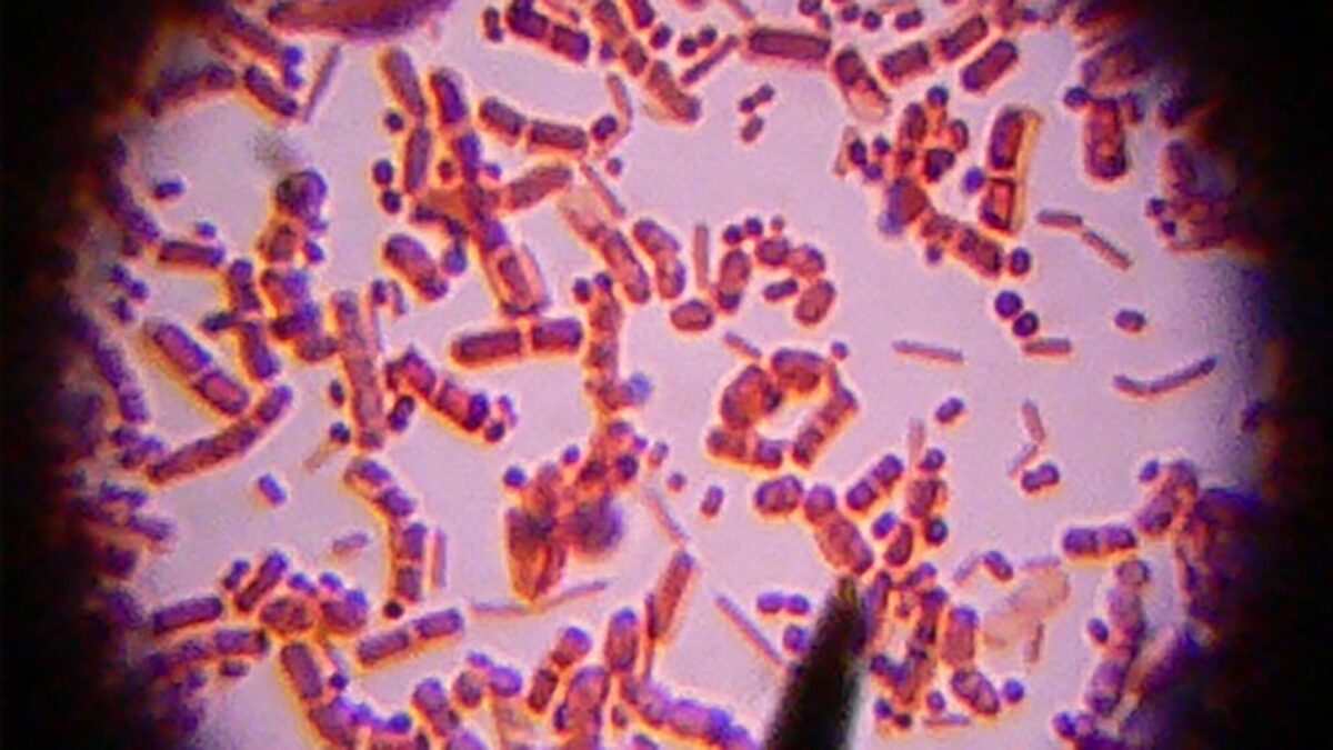 La listeriosis deja 56 hospitalizados en Andalucía y uno en Extremadura