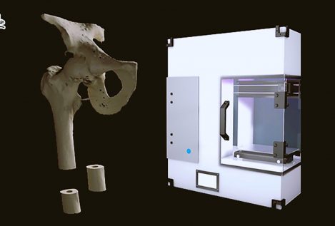 Un estudiante desarrolla una impresora 3D que reproduce 'huesos'