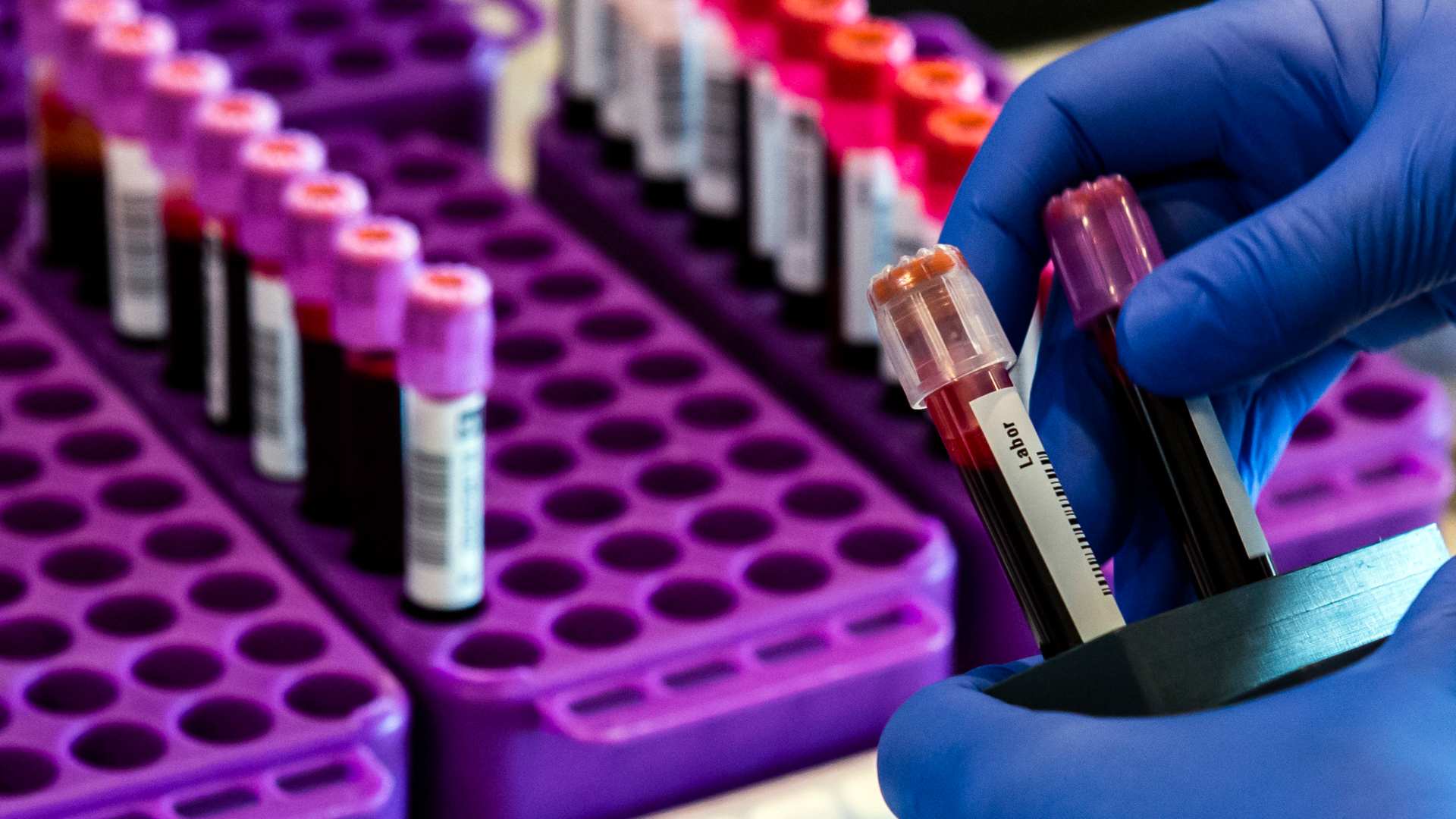 Un nuevo análisis de sangre detecta hasta 50 tipos de cáncer