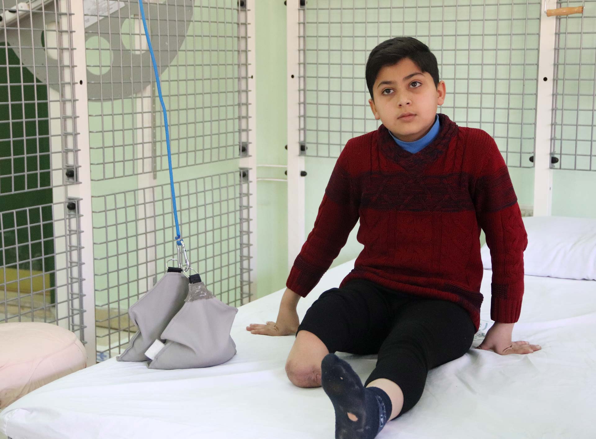 Aprender a vivir sin extremidades: Ahmad Hamish, el hospital sirio donde se recuperan los heridos por la guerra 5
