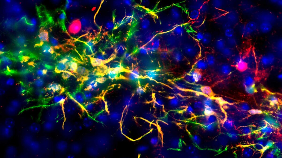 El cerebro también se puede donar (y no es necesario estar sano)