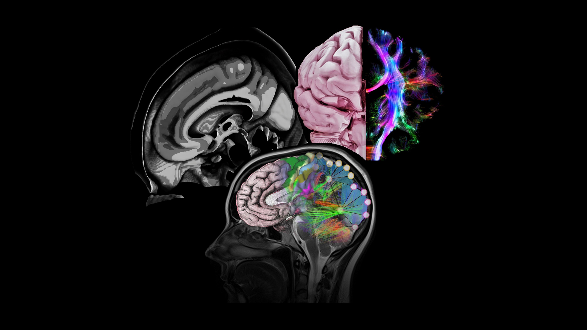 ¿Se puede concebir un cerebro separado de la persona?